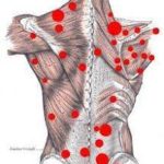 Miyofasyal Ağrı Sendromu (MAS)  ve Osteopatik Tedavisi