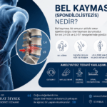 Bel Kayması (Spondilolistezis) Tedavisi