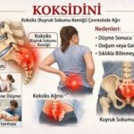 Kuyruk Sokumu Fizik Tedavi